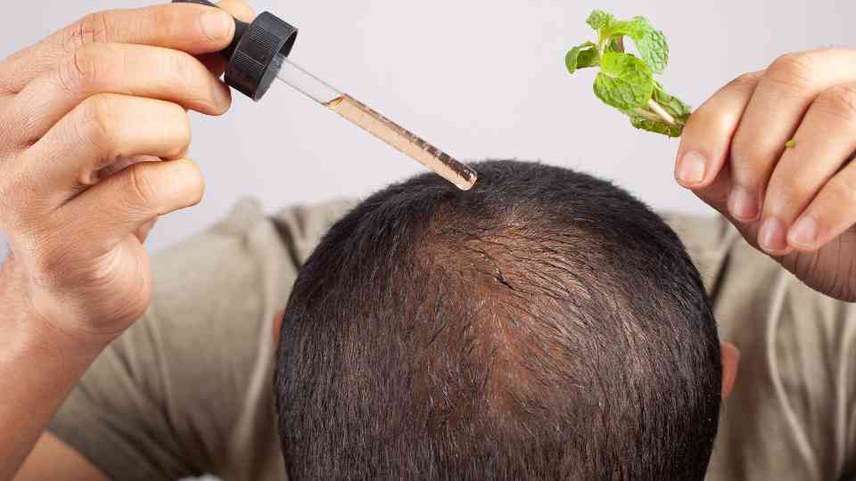Hair oil, shampoo, and medication can treat male pattern baldness and crown hair loss