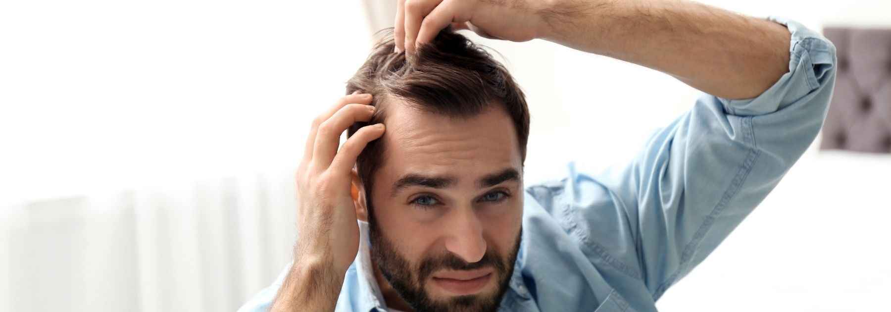 does creatine cause hair loss
