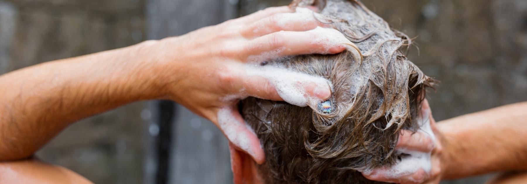 good shampoo for balding