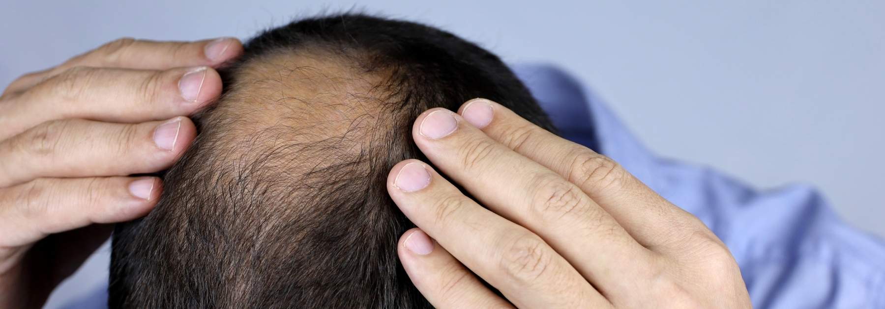 good shampoo for balding