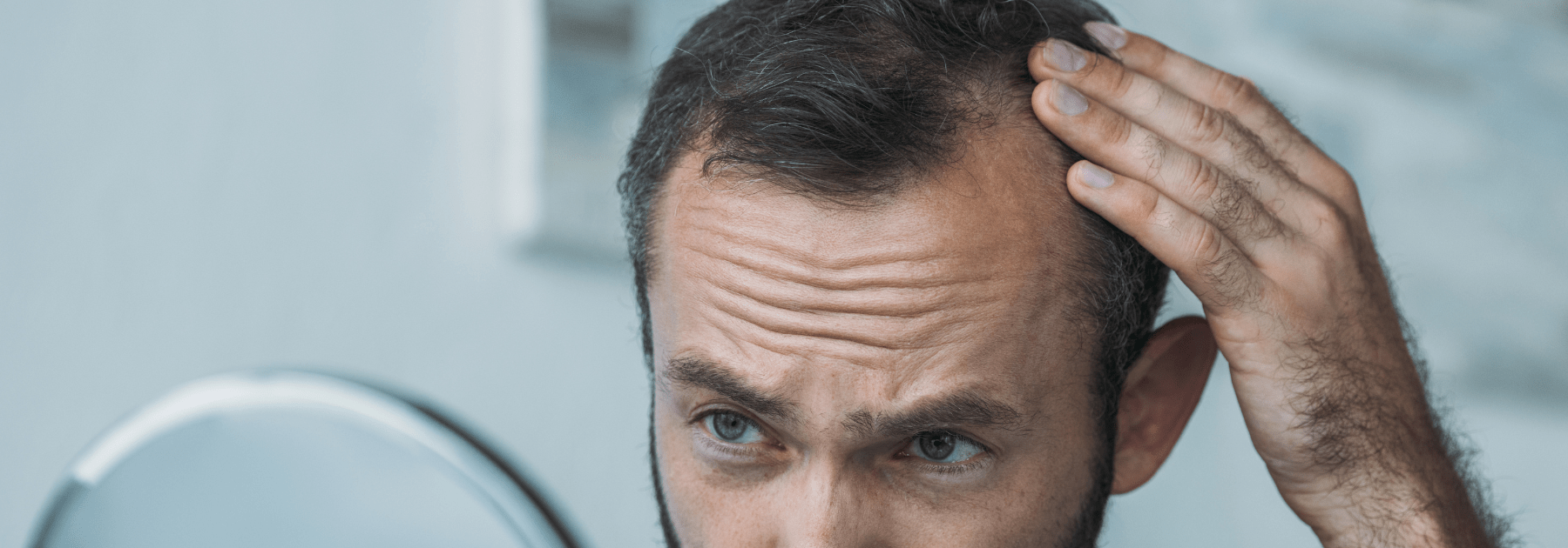 creatine and hair loss