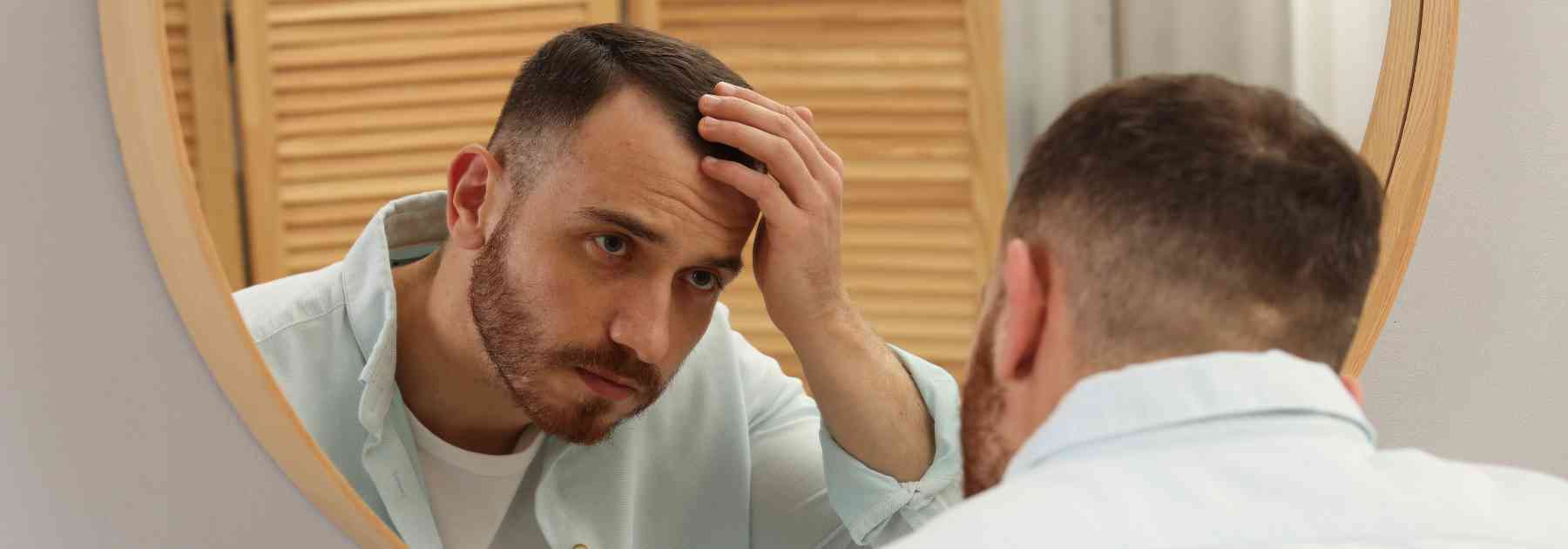 balding men treatment