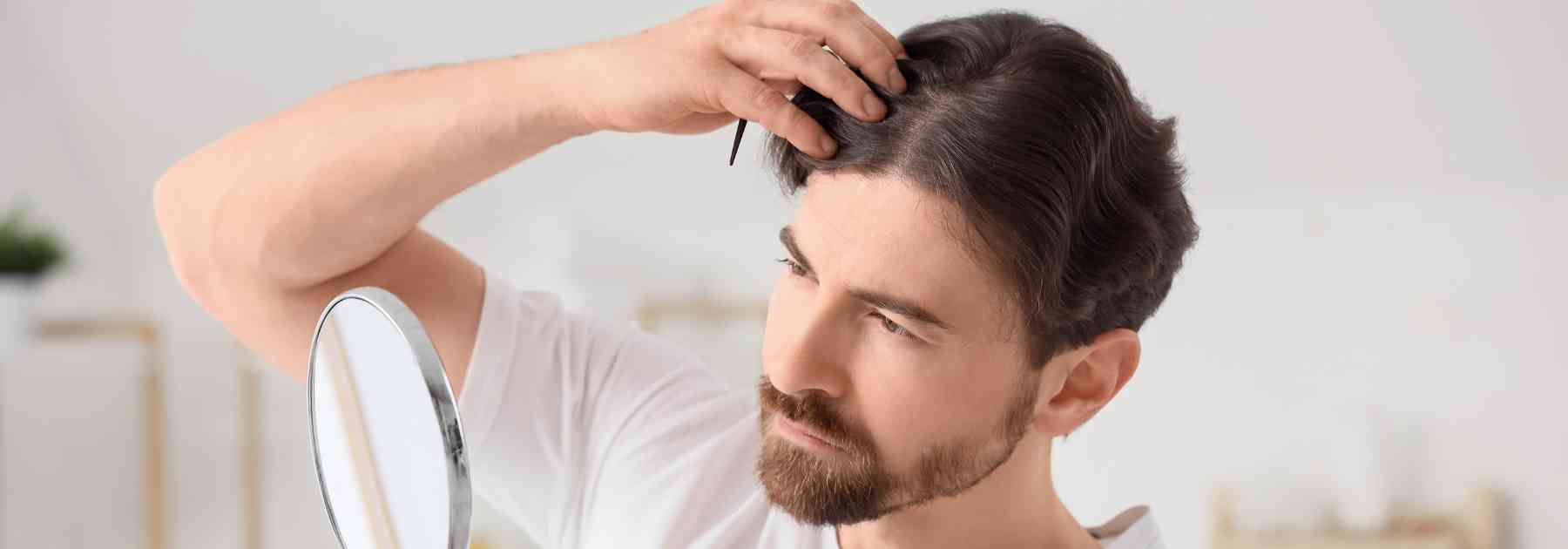 male pattern hair loss scotland