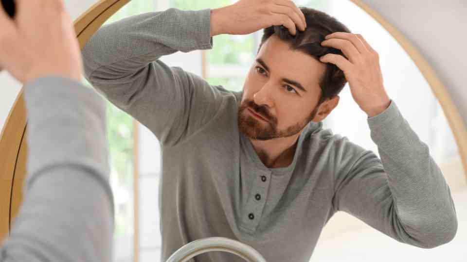 receding hair treatment